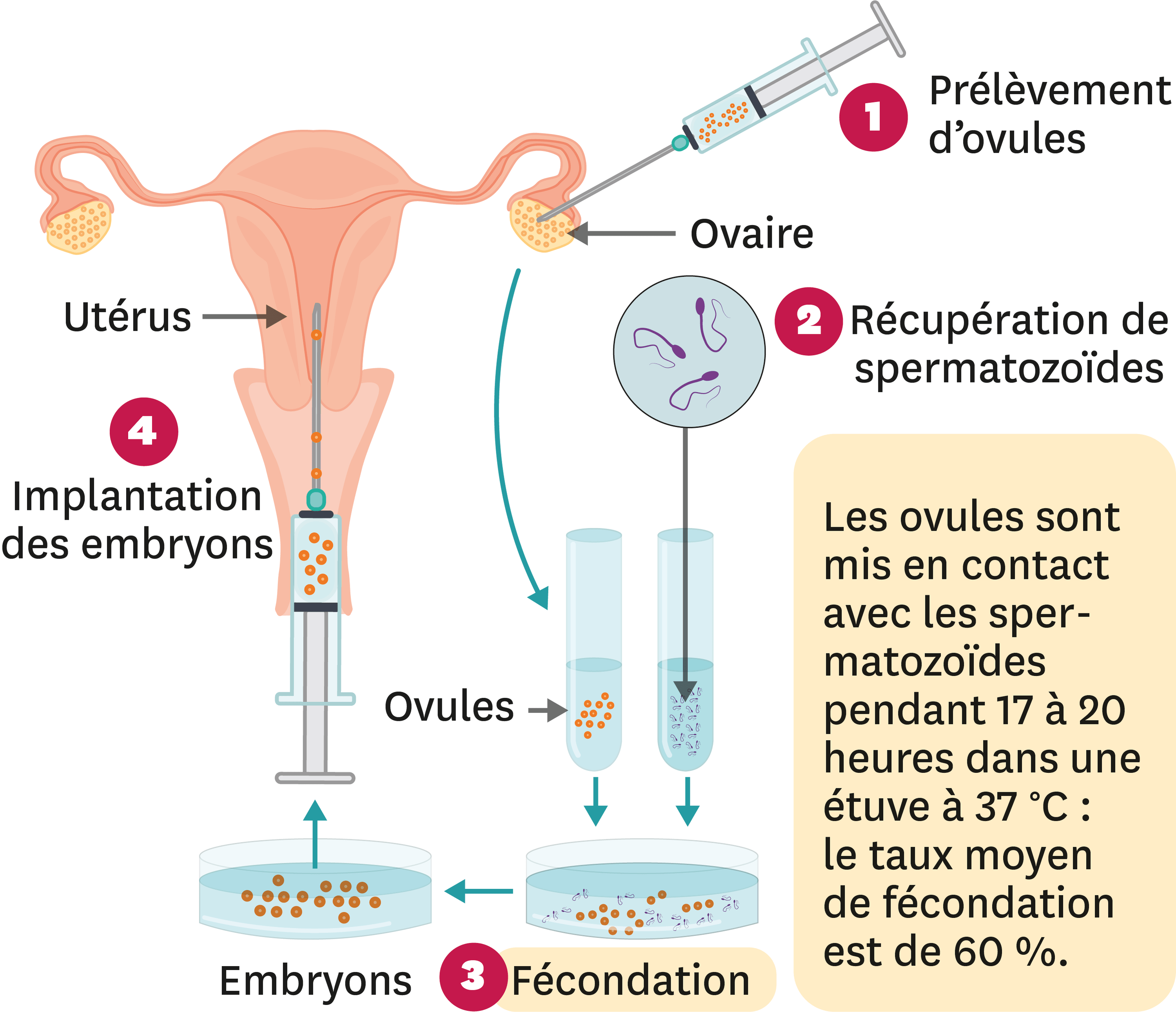 Le Principe De La Fivete F Condation In Vitro Et Transfert D Embryon