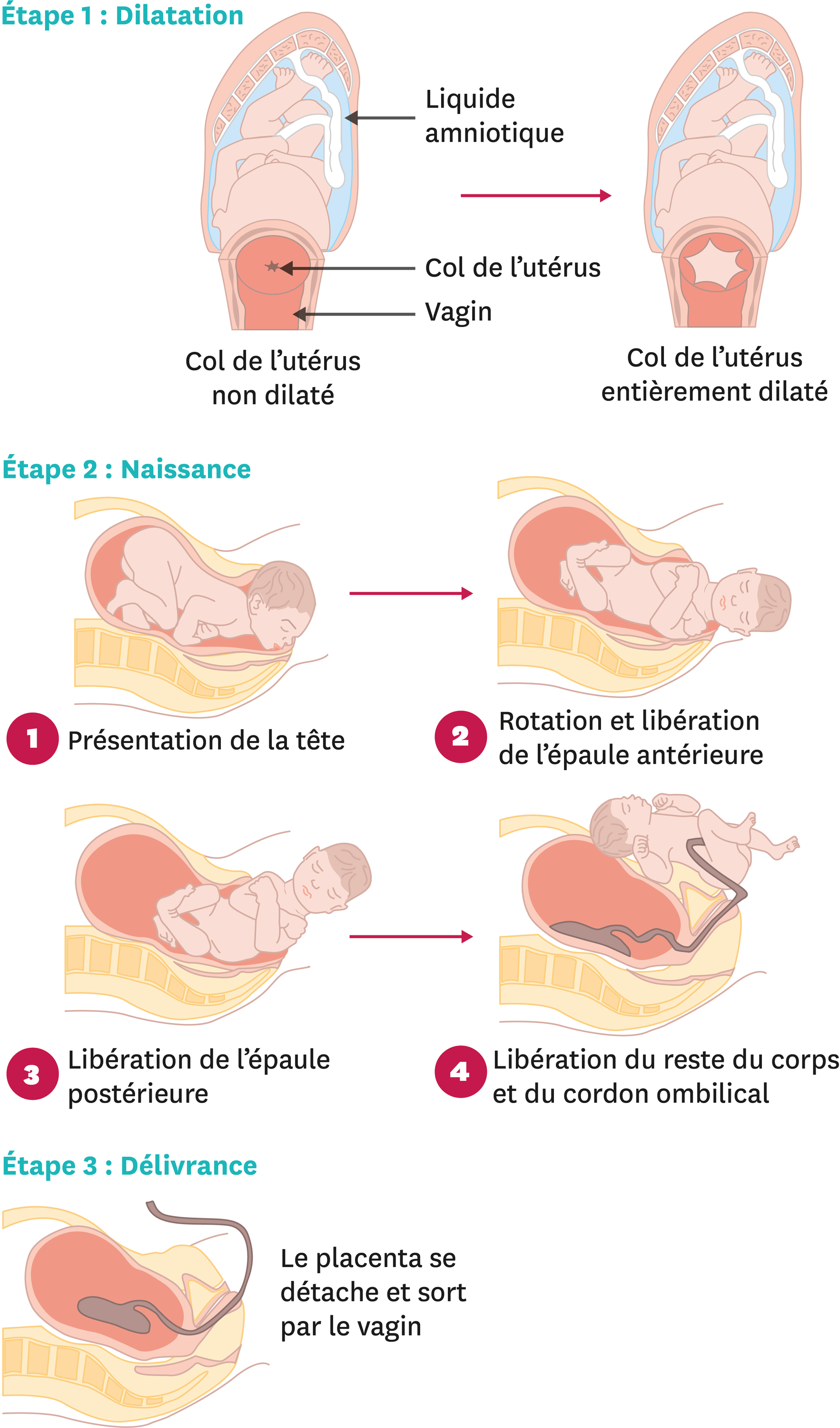 Les étapes De Laccouchement 7886