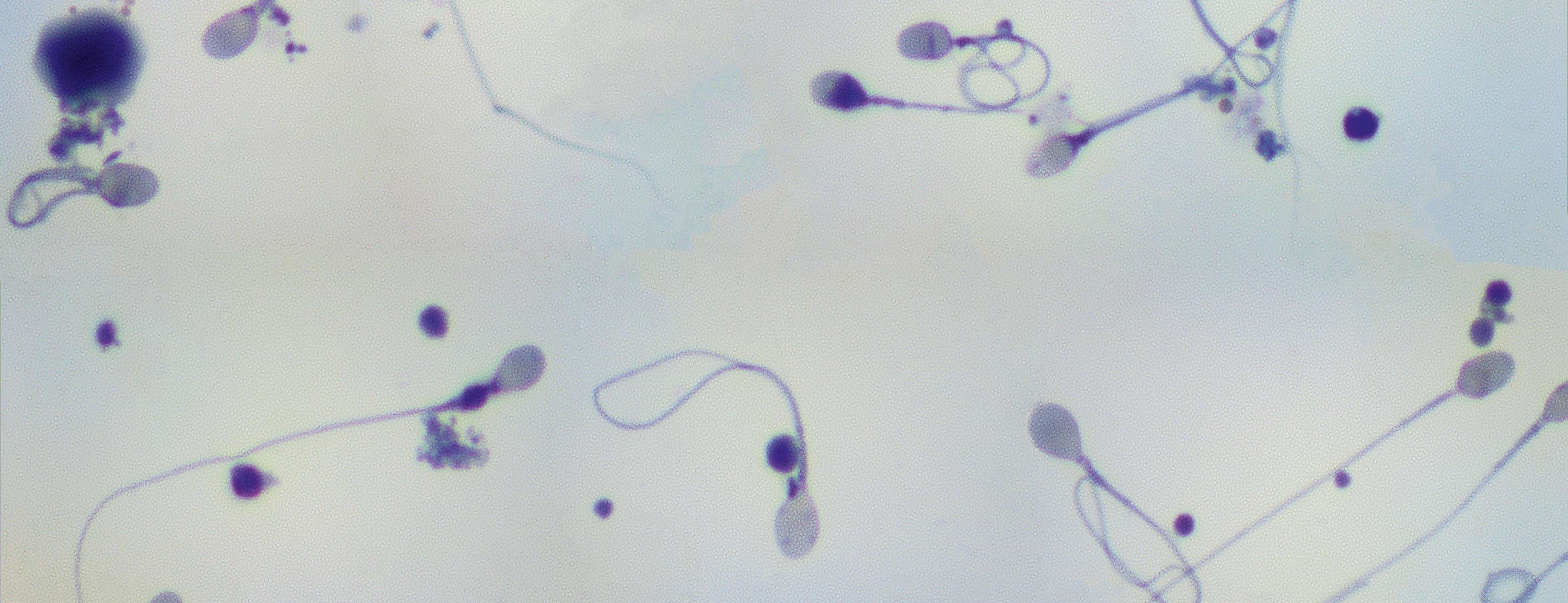 Observation de spermatozoïdes humains au microscope optique, grossisu00