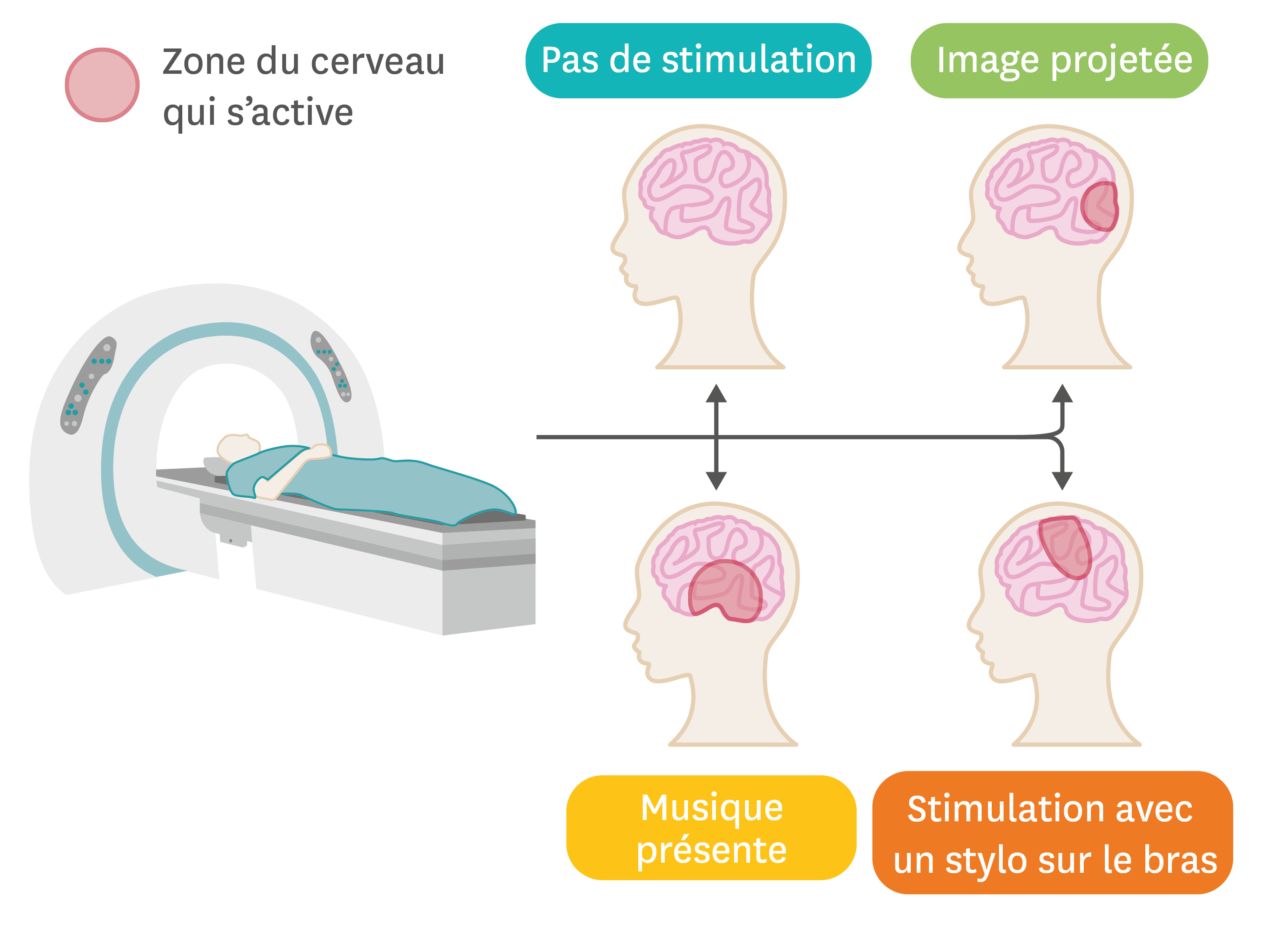 Lirm Permet De Visualiser Les Zones Dactivation Du Cerveau Hot Sex